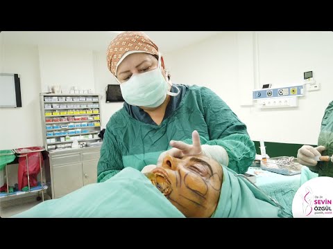 LIPO INJECTION I Dr.Sevin Özgül